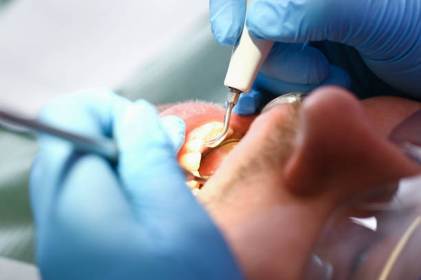 Best Mobile Emergency Dentist in Eagle Pass, TX