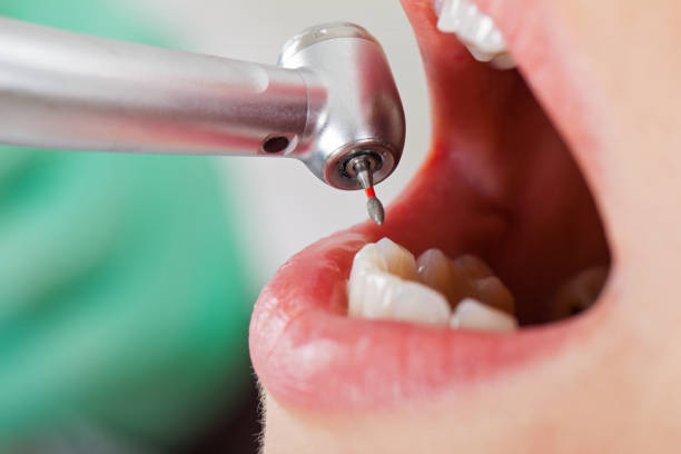Best Broken or Cracked Tooth Emergency Dentist in Eagle Pass, TX
